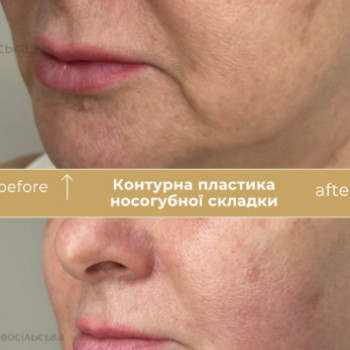 Фото с портфолио Клініка естетичної медицини Мирослави Новосільської