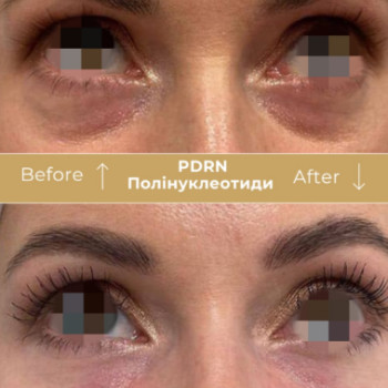 Фото с портфолио Клініка естетичної медицини Мирослави Новосільської