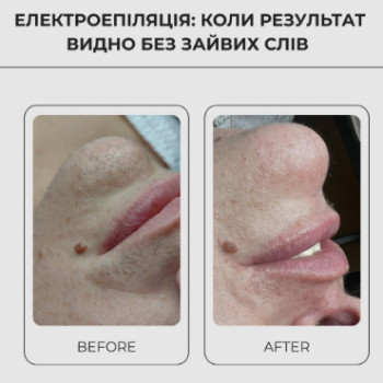 Фото с портфолио Клініка естетичної медицини Мирослави Новосільської