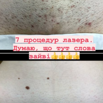 Фото с портфолио Наталія Ватилик