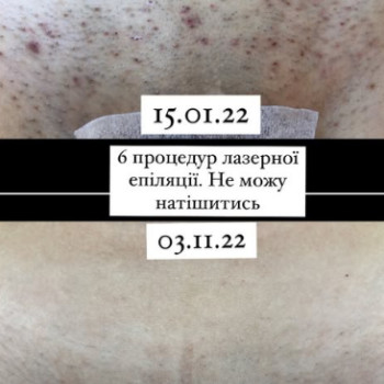 Фото с портфолио Наталія Ватилик