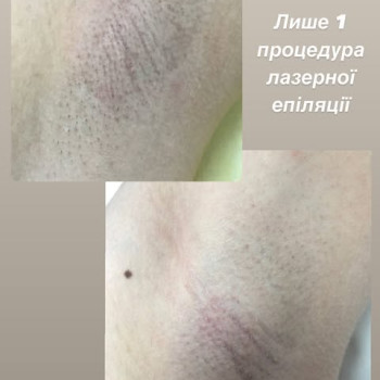 Фото с портфолио Наталія Ватилик