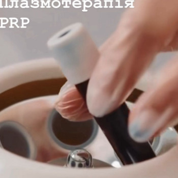PRP плазмотерапія
