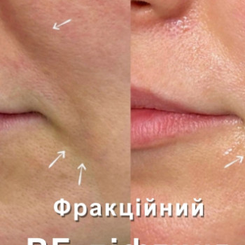 Фото с портфолио Вікторія Ільчишин