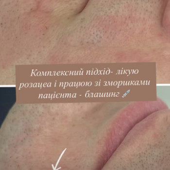 Фото с портфолио Вікторія Ільчишин
