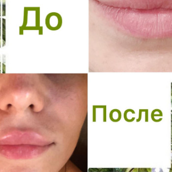 Фото с портфолио Светлана Лапко