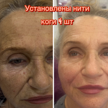 Фото с портфолио Наталя Грицай