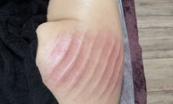 Ручная липопластика Масажист Татьяна Кропивницький