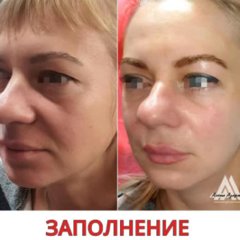 Фото с портфолио Олена Азарова