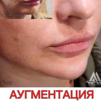 Фото с портфолио Олена Азарова