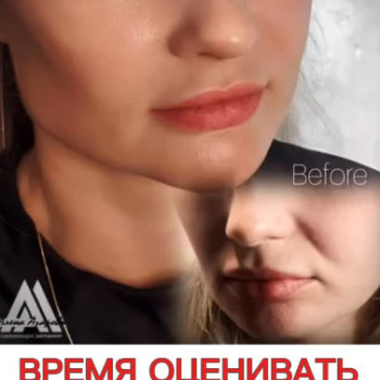 Фото с портфолио Олена Азарова