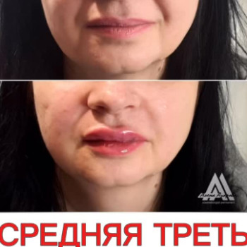 Фото с портфолио Олена Азарова
