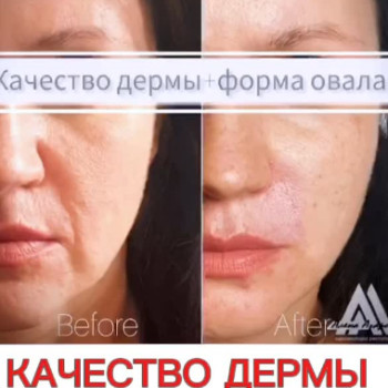 Фото с портфолио Олена Азарова