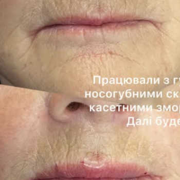 Фото с портфолио Вікторія Щербань