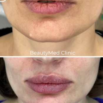 Фото с портфолио Beautymed Clinic
