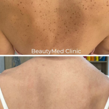 Фото с портфолио Beautymed Clinic