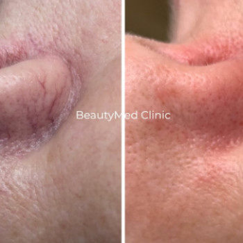 Фото с портфолио Beautymed Clinic