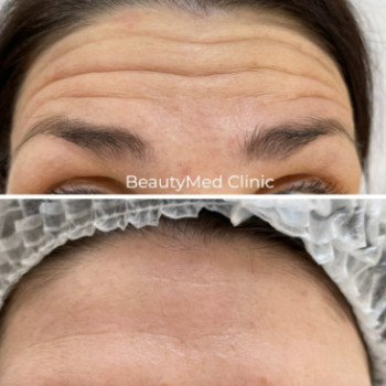 Фото с портфолио Beautymed Clinic