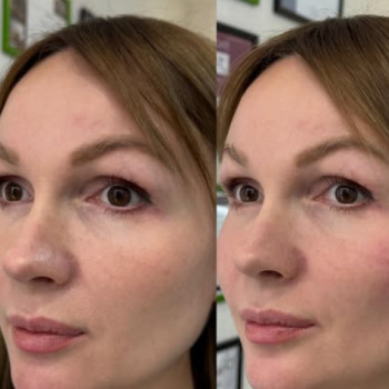 Фото с портфолио Beautymed Clinic