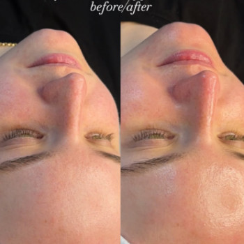 Фото с портфолио Beautymed Clinic