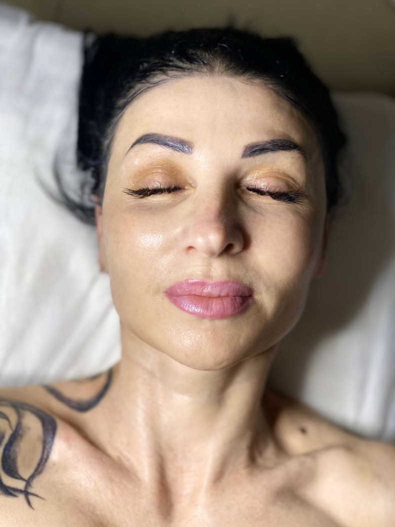 Збільшення губ контурна пластика аугментація, фото - Студія краси OLI'S BEAUTY STUDIO