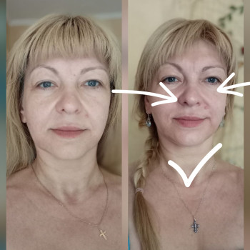Пропрацювали носогубки