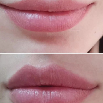 Фото с портфолио Beauty Line