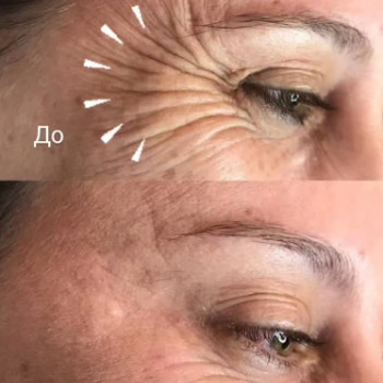 Фото с портфолио Beauty Line