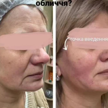 Фото с портфолио Beauty Line