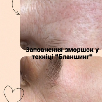 Фото с портфолио Beauty Line