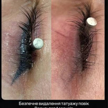 Видплення лазером стрілочок