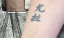 Безопасное лазерное удаление татуировок майстер з безпечного лазерного видалення татуажу т Роман Кропивницкий