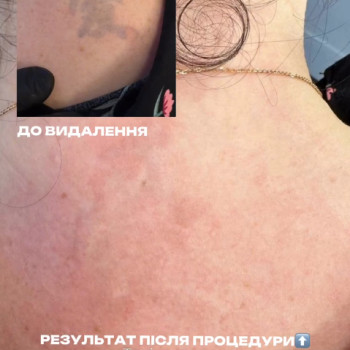 Фото с портфолио Роман Voroschuk