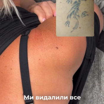 Фото с портфолио Роман Voroschuk