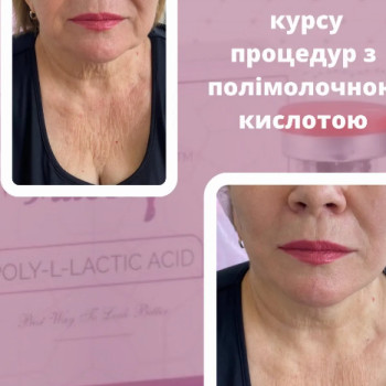 Фото с портфолио Вікторія Олександрівна Кушнір