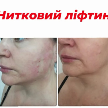 Фото с портфолио Вікторія Олександрівна Кушнір