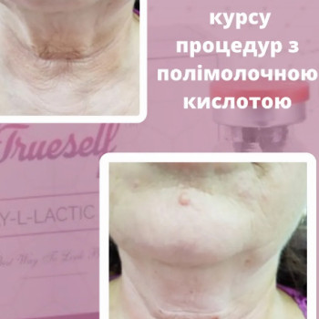 Фото с портфолио Вікторія Олександрівна Кушнір