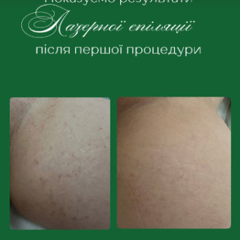 Фото с портфолио Центр красоты и здоровья «Авиценна Эстетик