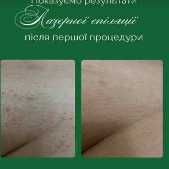 Фото с портфолио Центр красоты и здоровья «Авиценна Эстетик