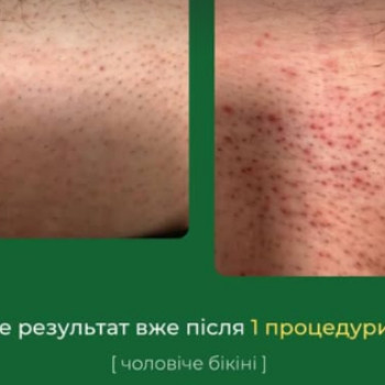 Фото с портфолио Центр красоты и здоровья «Авиценна Эстетик