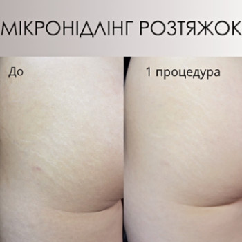 Фото с портфолио Ольга Лопатнева