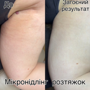 Фото с портфолио Ольга Лопатнева