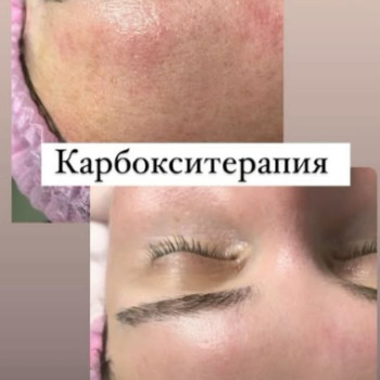 Фото с портфолио Катерина Сіліна