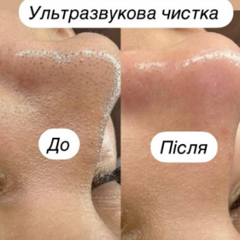 Фото с портфолио Катерина Сіліна