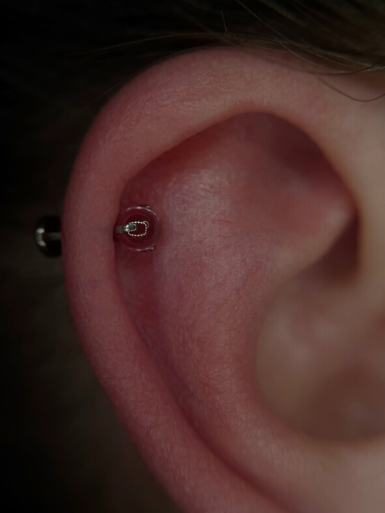Пірсинг вуха хелікс, фото - Тату салон TATTOO LAMARCH