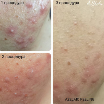 Фото с портфолио Анна 