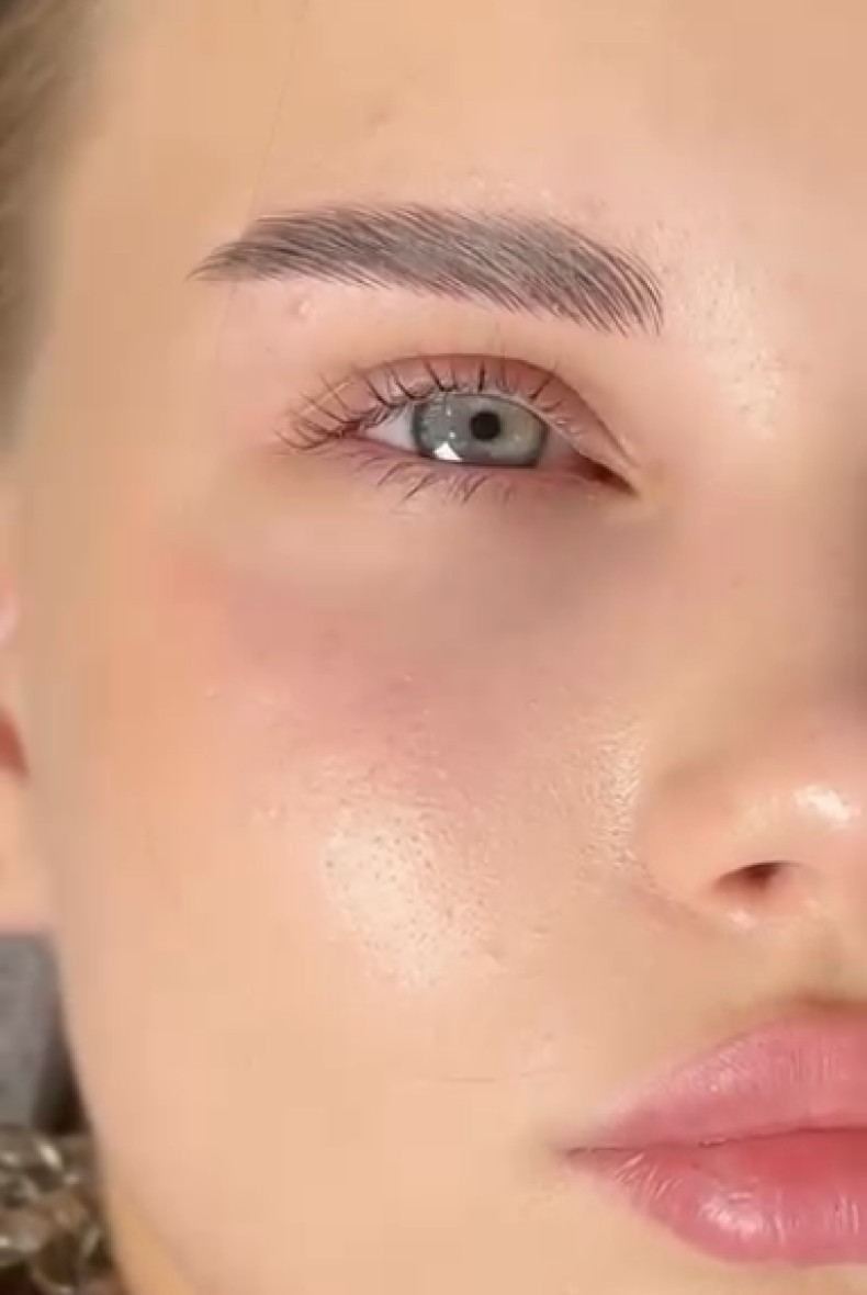 Збільшення губ контурна пластика аугментація, фото - Лешмейкер Анна Куксова