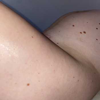 Фото с портфолио Sugaring silky skin lviv