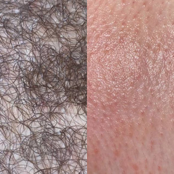 Фото с портфолио Sugaring silky skin lviv