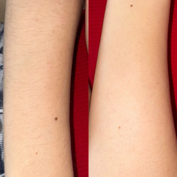 Фото с портфолио Sugaring silky skin lviv